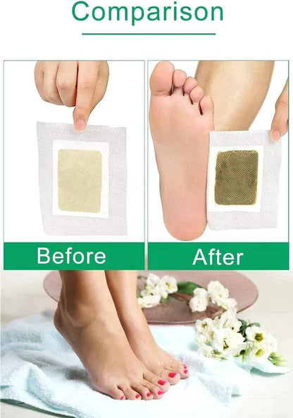 Detox Foot Patches (Set of 10)